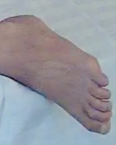 foot guest 1 11-13-22
