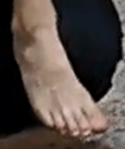 foot Barbara 7-5-22