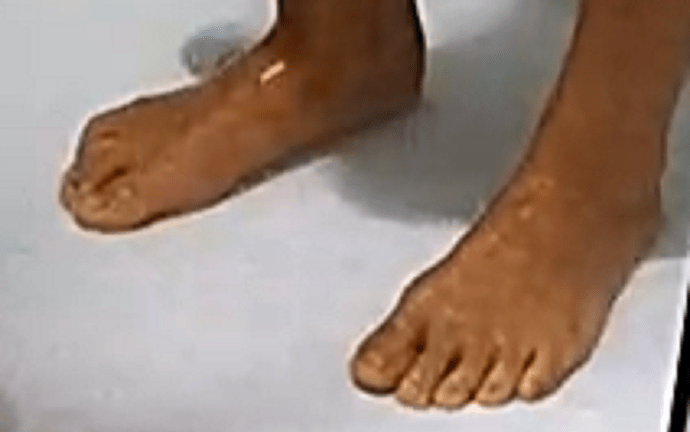 feet Sarah 10-13-22