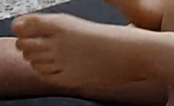 foot Flame 5-2-22