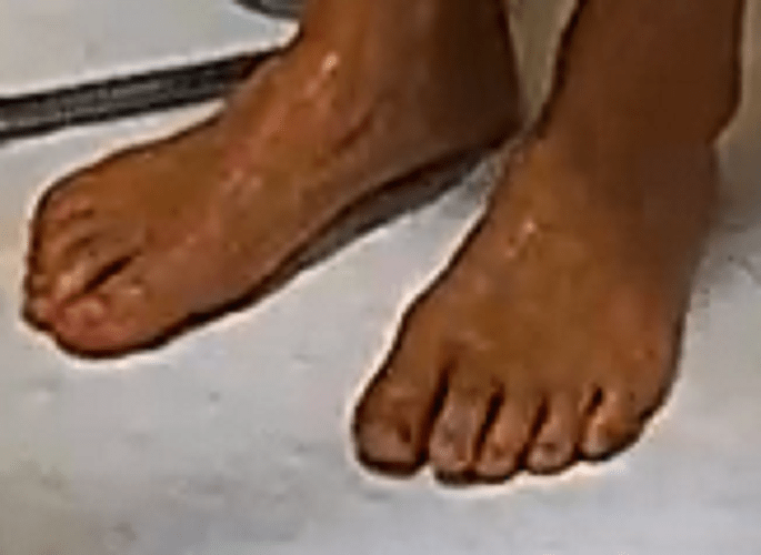 feet Auriel 9-25-22