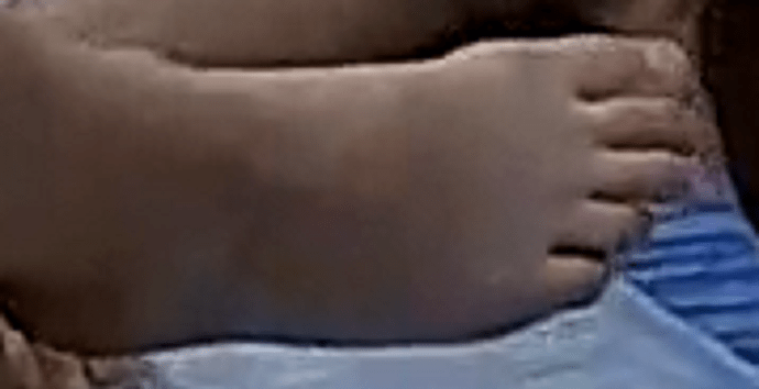 Barbara foot 3-19-22