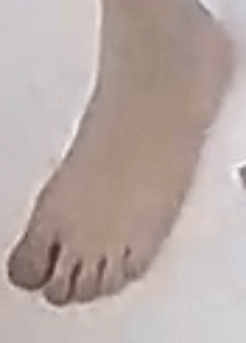 foot Goldie 11-22-22