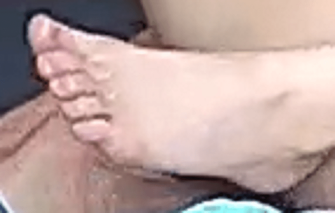 foot Chloe 7-16-22 1