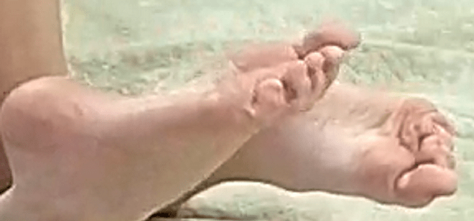 Feet Elisha 4-11-22