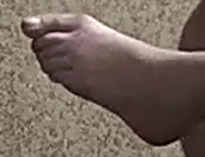 feet Diu 6-6-22 4