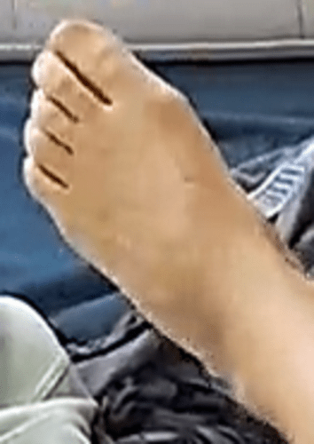 foot Auriel 5-20-22 3