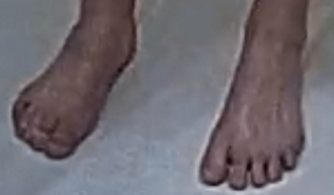 feet Jaz 5-21-22