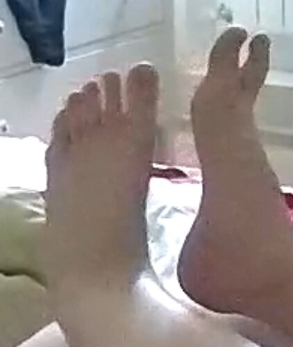 feet Indira 6-18-22 2