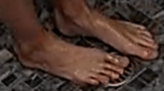 feet Roisin 8-2-22 5