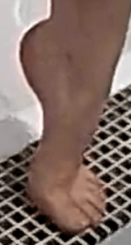 foot Chyna 7-2-22