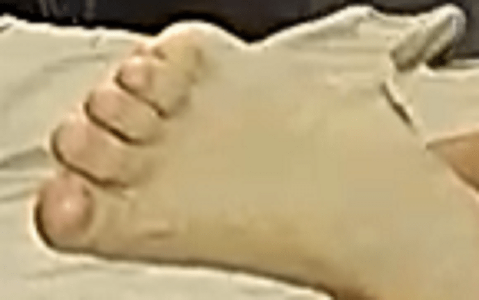 foot Flora 6-11-22 2