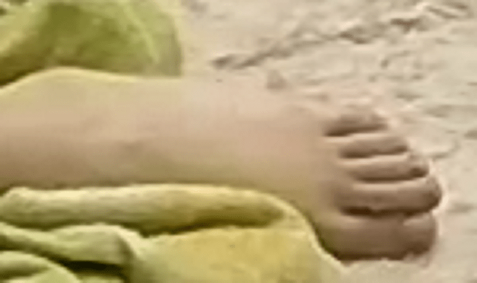 foot Goldie 9-14-22