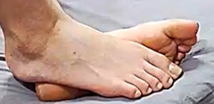 feet Candy red 6-27-22 1