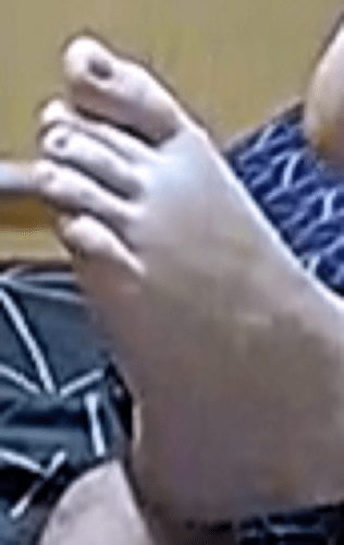 foot Ariela 1-14-23 4