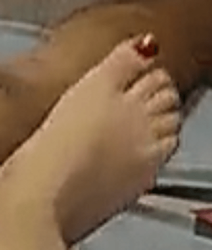 foot Arya 8-19-22 1
