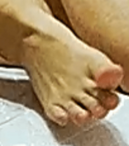 foot Gella 9-25-22 3