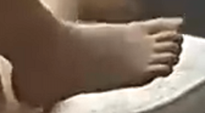 foot Alana 6-27-22