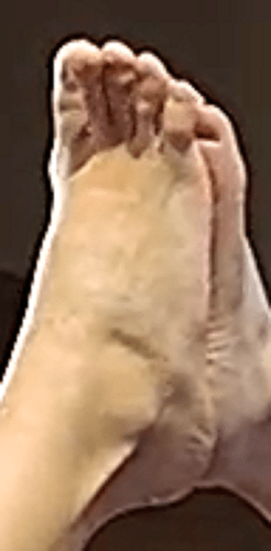 feet Kortney 7-10-22 3