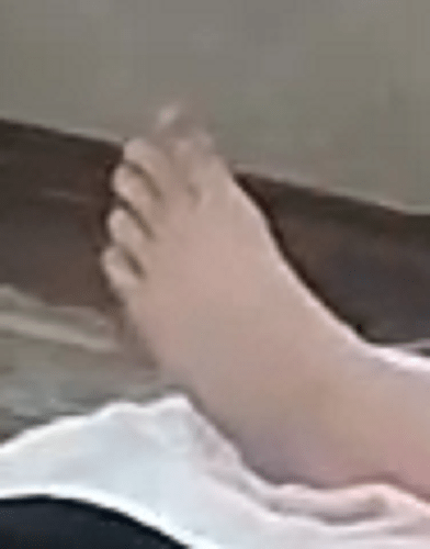 foot Artems girl 5-4-22