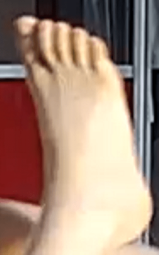 foot Alana 7-13-22 6