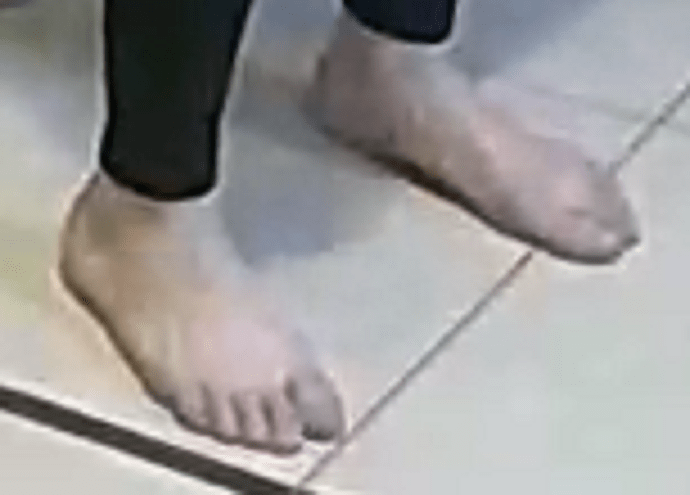 feet Silver 1-11-23