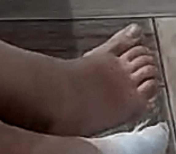 foot Floras Bfriend 8-1-22