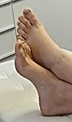 feet Flora 6-1-22