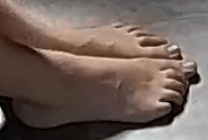 feet Elisha 10-25-22