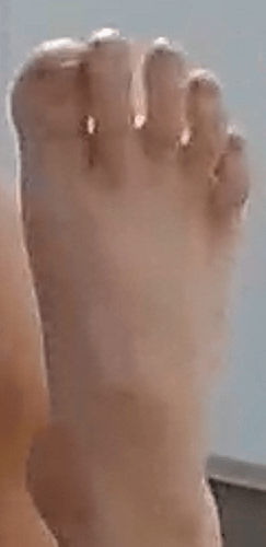foot Ailya 7-10-22 4