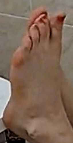 feet Ally 6-2-22