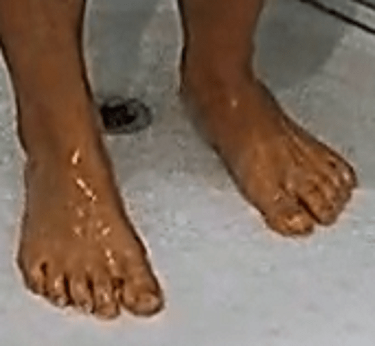 feet Auriel 6-11-22