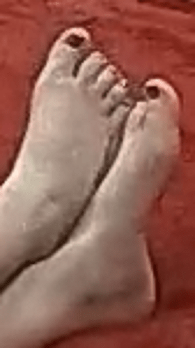 feet Marica 8-29-22 2