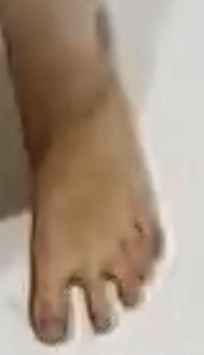 foot Ana 9-13-17