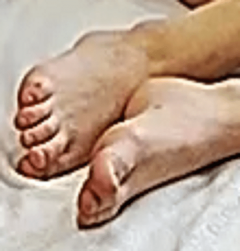feet Viola 9-27-22