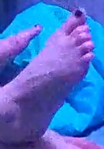 foot Camilla 7-16-22