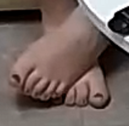 feet Marica 6-20-22