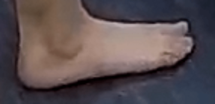 foot Chyna 7-10-22