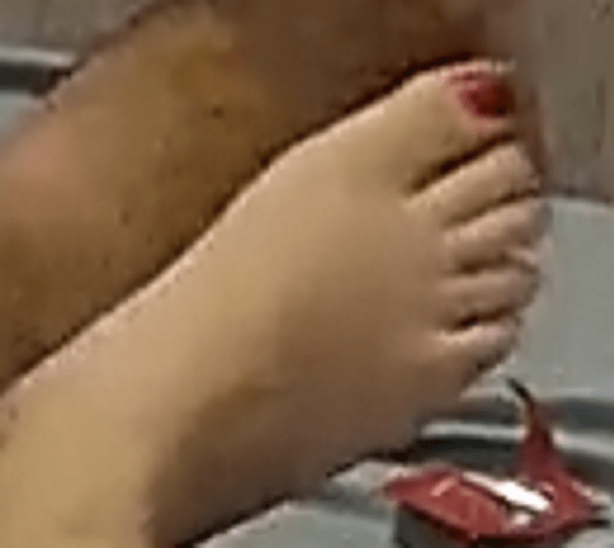foot Arya 8-19-22 3