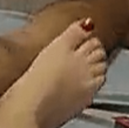 foot Arya 8-19-22 6