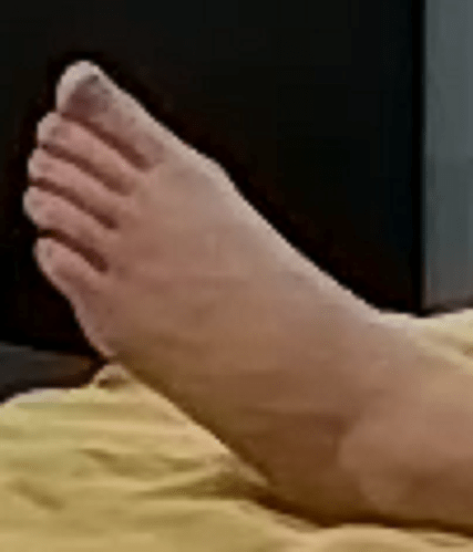 foot Elisha 11-7-22