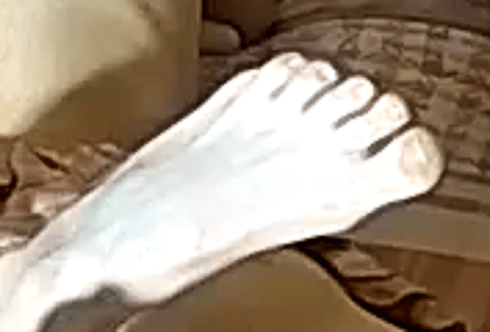 foot Cindy 4-7-23