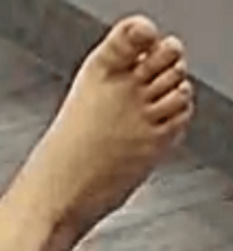 foot Flora 2-27=23
