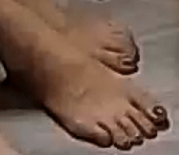 feet Mira 7-6-22