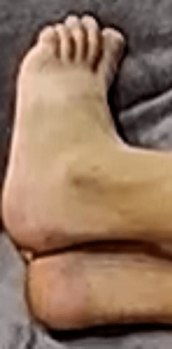 feet Zoja 8-9-22