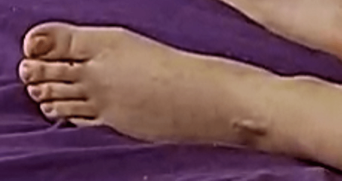 foot Goldie 8-18-22 4