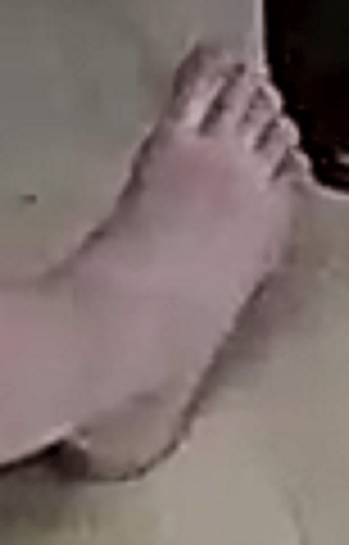 foot Edna 7-6-22