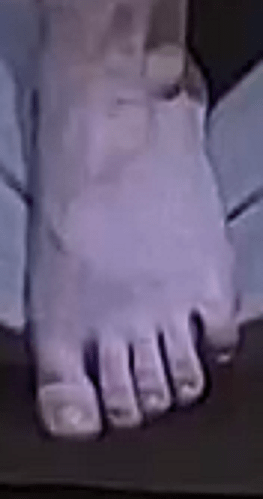 foot Annabella 2-16-23