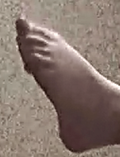 feet Diu 6-6-22 9