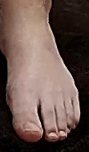 foot Barbara 6-21-22